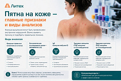 Пятна на коже - главные признаки и виды анализов
