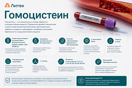 Гомоцистеин